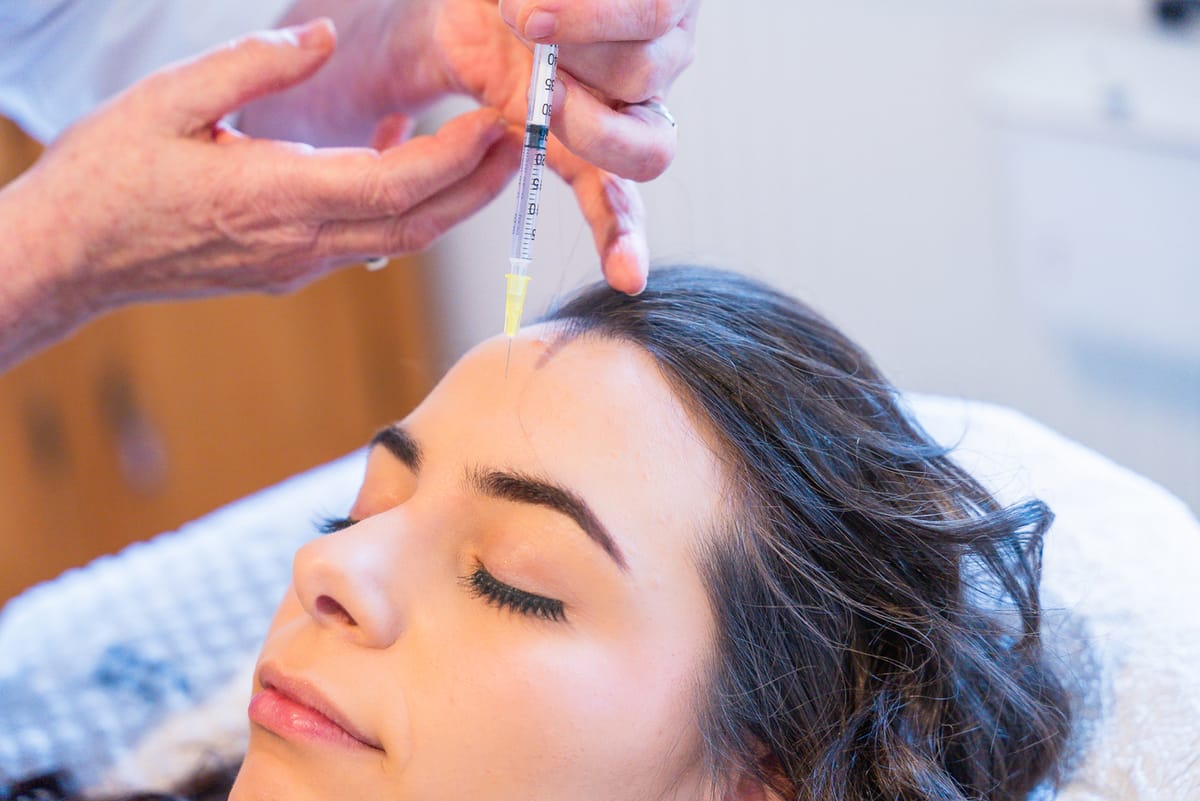 Botox-Injektion in die Stirnpartie bei Hannover Beauty